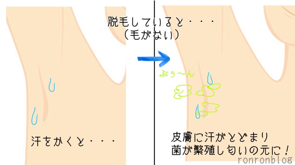 脱毛しているとなぜわきが匂うのか?